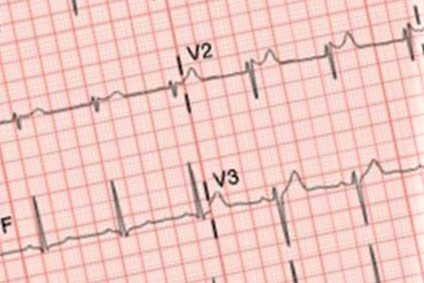 EKG Hausarzt Wichtrach